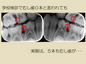 小児歯科